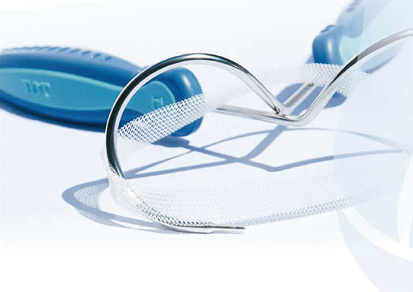 TOT无张力悬吊带